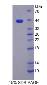 HDAC9 Protein - Recombinant  Histone Deacetylase 9 By SDS-PAGE