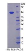 HDAC9 Protein - Recombinant  Histone Deacetylase 9 By SDS-PAGE