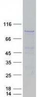 HDAC9 Protein - Purified recombinant protein HDAC9 was analyzed by SDS-PAGE gel and Coomassie Blue Staining