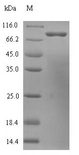 HDC / Histidine Decarboxylase Protein - (Tris-Glycine gel) Discontinuous SDS-PAGE (reduced) with 5% enrichment gel and 15% separation gel.