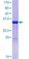 HDDC3 Protein - 12.5% SDS-PAGE of human HDDC3 stained with Coomassie Blue