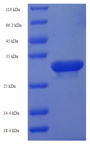 HDDC3 Protein