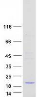 HDDC3 Protein - Purified recombinant protein HDDC3 was analyzed by SDS-PAGE gel and Coomassie Blue Staining