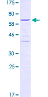HDGF Protein - 12.5% SDS-PAGE of human HDGF stained with Coomassie Blue