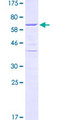 HDGF Protein - 12.5% SDS-PAGE of human HDGF stained with Coomassie Blue