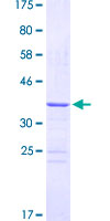 HDGF Protein - 12.5% SDS-PAGE Stained with Coomassie Blue.