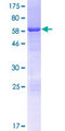 HDGFL1 Protein - 12.5% SDS-PAGE of human HDGFL1 stained with Coomassie Blue