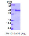 HDGFL1 Protein