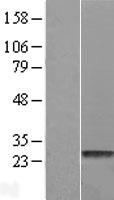 HDHD1 Protein - Western validation with an anti-DDK antibody * L: Control HEK293 lysate R: Over-expression lysate