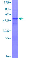 HDHD1 Protein - 12.5% SDS-PAGE of human HDHD1A stained with Coomassie Blue