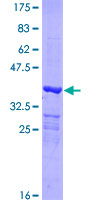 HDHD1 Protein - 12.5% SDS-PAGE Stained with Coomassie Blue.
