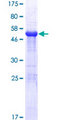 HDHD2 Protein - 12.5% SDS-PAGE of human HDHD2 stained with Coomassie Blue