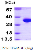 HDHD2 Protein