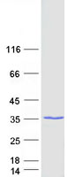 HDHD3 Protein - Purified recombinant protein HDHD3 was analyzed by SDS-PAGE gel and Coomassie Blue Staining