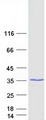 HDHD3 Protein - Purified recombinant protein HDHD3 was analyzed by SDS-PAGE gel and Coomassie Blue Staining