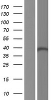 HDS / DHDDS Protein - Western validation with an anti-DDK antibody * L: Control HEK293 lysate R: Over-expression lysate