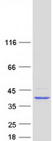 HDS / DHDDS Protein - Purified recombinant protein DHDDS was analyzed by SDS-PAGE gel and Coomassie Blue Staining