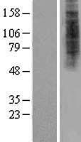 HDX Protein - Western validation with an anti-DDK antibody * L: Control HEK293 lysate R: Over-expression lysate