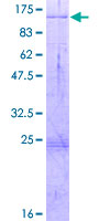 HDX Protein - 12.5% SDS-PAGE of human HDX stained with Coomassie Blue