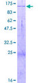 HDX Protein - 12.5% SDS-PAGE of human HDX stained with Coomassie Blue