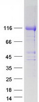 HEATR6 / ABC1 Protein - Purified recombinant protein HEATR6 was analyzed by SDS-PAGE gel and Coomassie Blue Staining