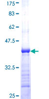 HEBP1 Protein - 12.5% SDS-PAGE Stained with Coomassie Blue.