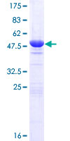 HEBP2 Protein - 12.5% SDS-PAGE of human HEBP2 stained with Coomassie Blue