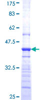 HEBP2 Protein - 12.5% SDS-PAGE Stained with Coomassie Blue.