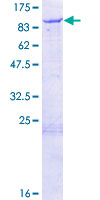 HEC1 / NDC80 Protein - 12.5% SDS-PAGE of human NDC80 stained with Coomassie Blue