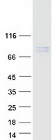 HEC1 / NDC80 Protein - Purified recombinant protein NDC80 was analyzed by SDS-PAGE gel and Coomassie Blue Staining