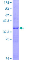 HECA Protein - 12.5% SDS-PAGE Stained with Coomassie Blue.
