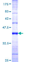 HECTD1 Protein - 12.5% SDS-PAGE Stained with Coomassie Blue.