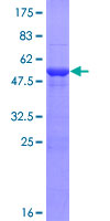HECTD2 Protein - 12.5% SDS-PAGE of human HECTD2 stained with Coomassie Blue