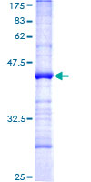 HECTD2 Protein - 12.5% SDS-PAGE Stained with Coomassie Blue.