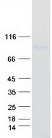 HECTD2 Protein - Purified recombinant protein HECTD2 was analyzed by SDS-PAGE gel and Coomassie Blue Staining