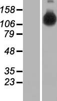 HELB Protein - Western validation with an anti-DDK antibody * L: Control HEK293 lysate R: Over-expression lysate