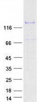 HELB Protein - Purified recombinant protein HELB was analyzed by SDS-PAGE gel and Coomassie Blue Staining
