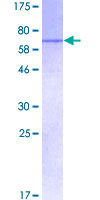 HELLS Protein - 12.5% SDS-PAGE of human HELLS stained with Coomassie Blue