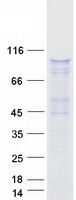 HELLS Protein - Purified recombinant protein HELLS was analyzed by SDS-PAGE gel and Coomassie Blue Staining