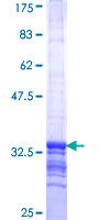 HELQ / HEL308 Protein