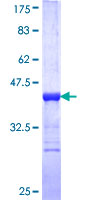 HELZ Protein - 12.5% SDS-PAGE Stained with Coomassie Blue.