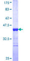 HELZ Protein - 12.5% SDS-PAGE Stained with Coomassie Blue.