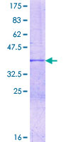 HELZ2 / PRIC285 Protein - 12.5% SDS-PAGE Stained with Coomassie Blue.
