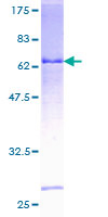 HEMK1 Protein - 12.5% SDS-PAGE of human HEMK1 stained with Coomassie Blue