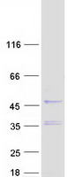 HEMK1 Protein - Purified recombinant protein HEMK1 was analyzed by SDS-PAGE gel and Coomassie Blue Staining