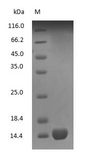 Hemoglobin Protein - (Tris-Glycine gel) Discontinuous SDS-PAGE (reduced) with 5% enrichment gel and 15% separation gel.