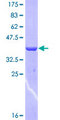 HEPH / Hephaestin Protein - 12.5% SDS-PAGE Stained with Coomassie Blue.