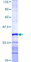 HERC3 Protein - 12.5% SDS-PAGE Stained with Coomassie Blue.