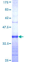 HERC4 Protein - 12.5% SDS-PAGE Stained with Coomassie Blue.
