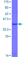 HERC6 Protein - 12.5% SDS-PAGE Stained with Coomassie Blue.